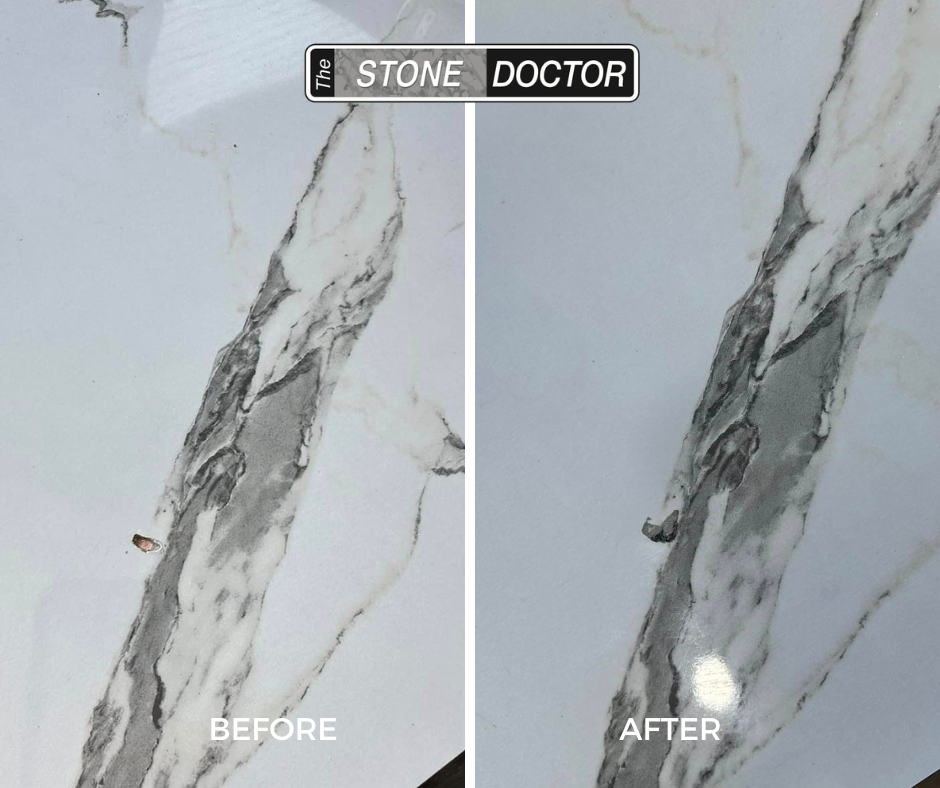 Stone-Doctor-Hole-in